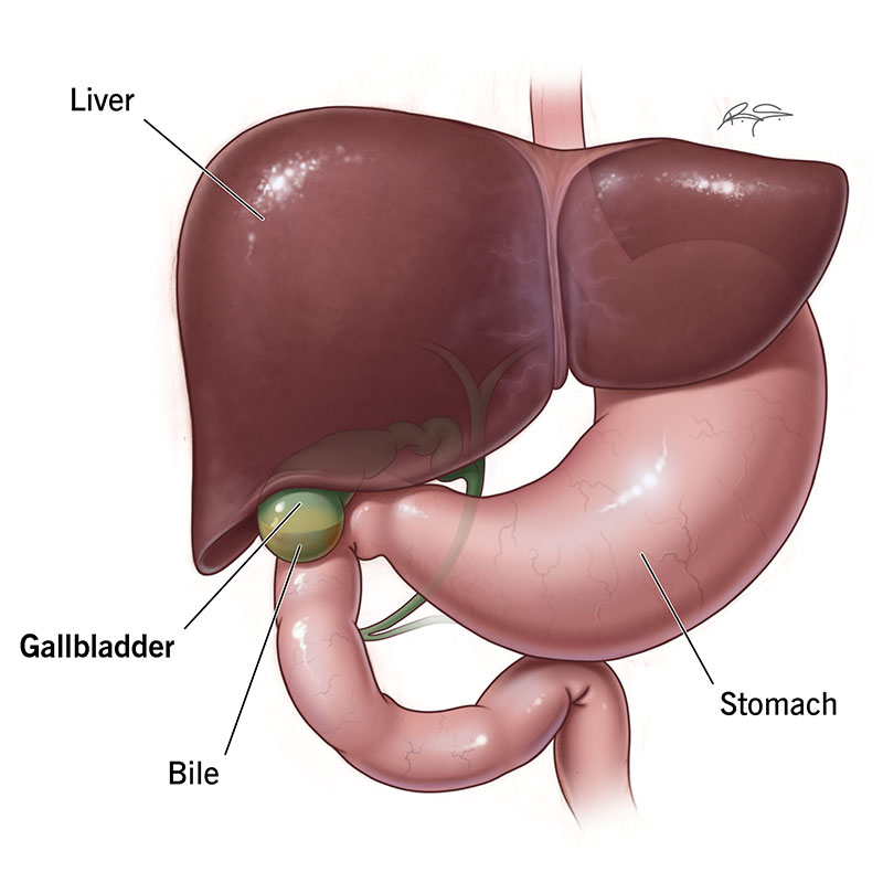 Gallbladder Distress